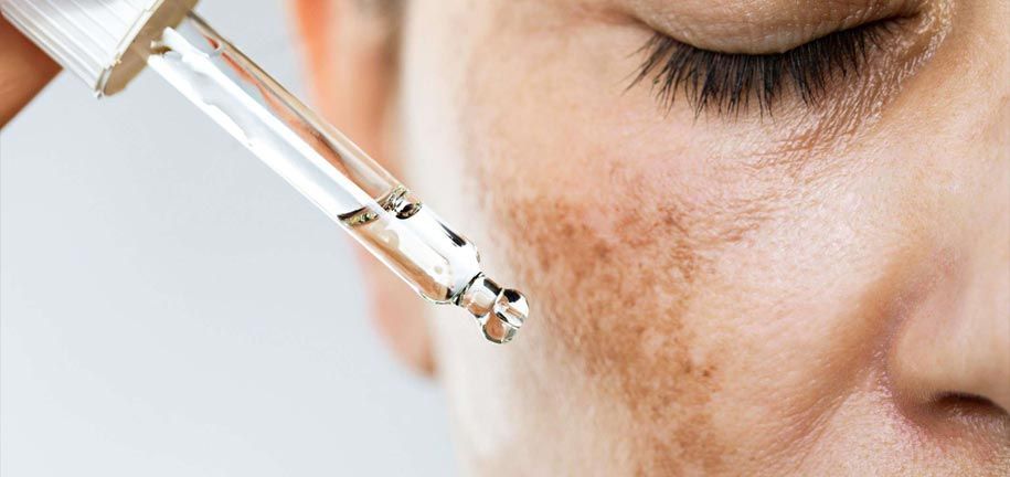 Moyens efficaces pour traiter l'hyperpigmentation