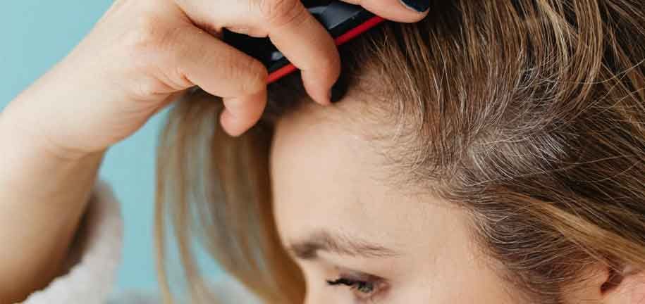 Se débarrasser des pellicules