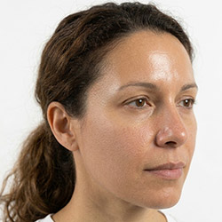 Soins pour peau mixte