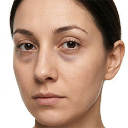 Soins contour des yeux pour cernes et poches