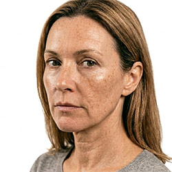 Produits de soin éclaircissants pour la peau