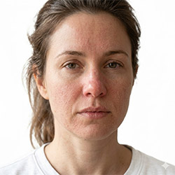 Soin pour peau sèche et irritée
