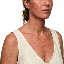 Produits de soin professionnels conçus pour améliorer l’apparence de la peau abîmée par le soleil