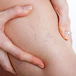 cosmétiques toniques veineux